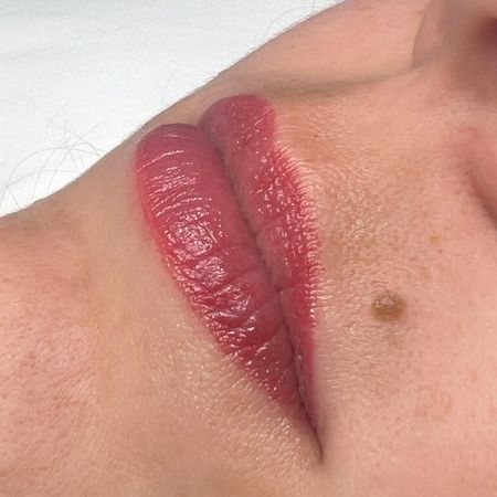 Lippenpigmentierung