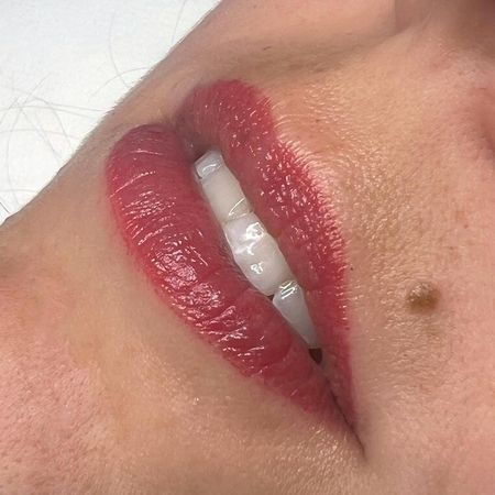 Lippenpigmentierung